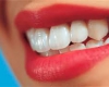 بهترین روش برای سفید کردن دندانها